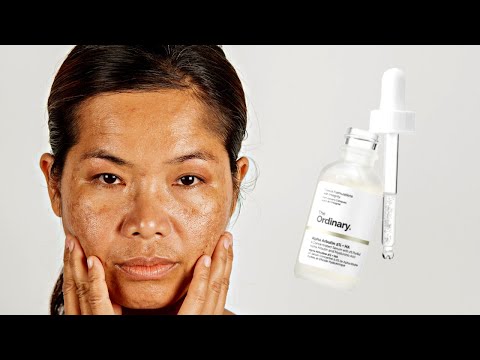The Ordinary Alpha Arbutin 2% + HA 30ml
